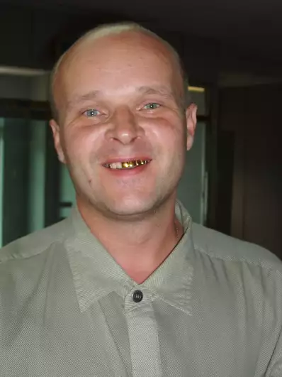 Gold teeth are popular in Russia